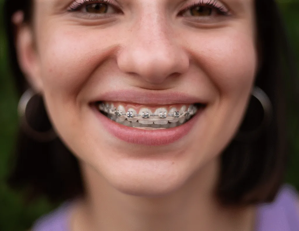 Ortodoncia-monte-grande