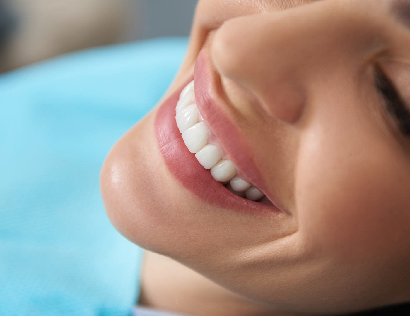 estética-dental-en-Monte-Grande